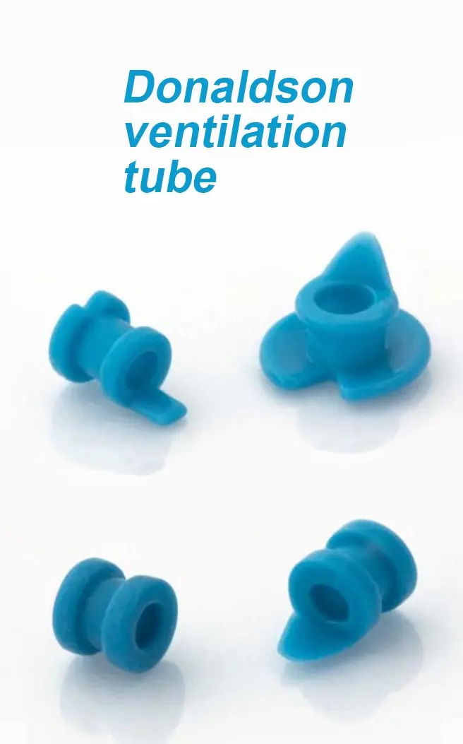 Donaldson ventilation tube