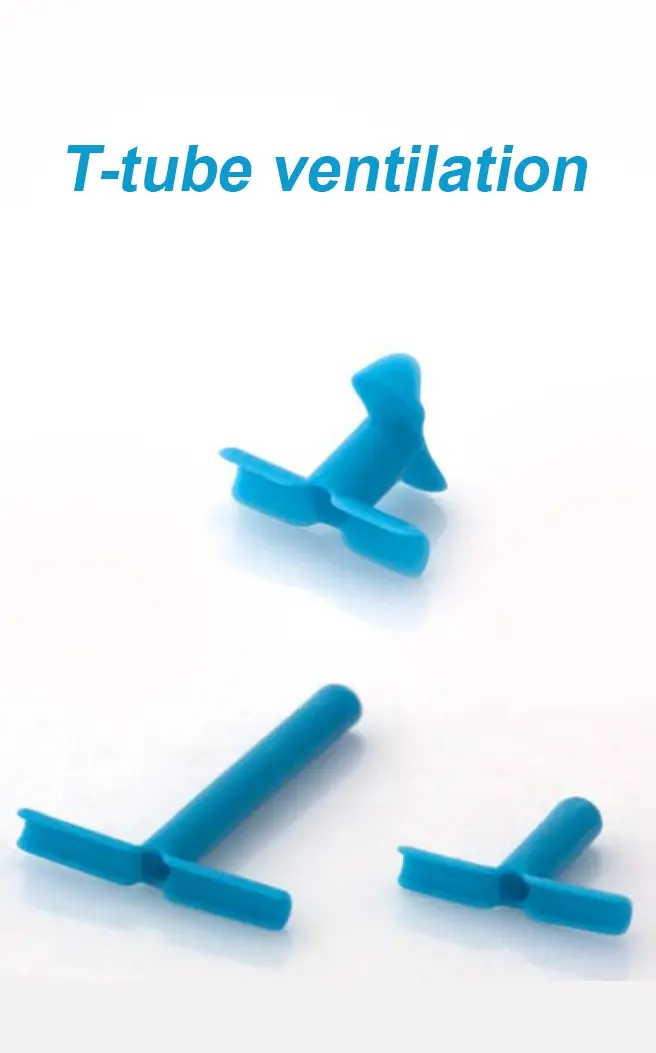 T-tube ventilation